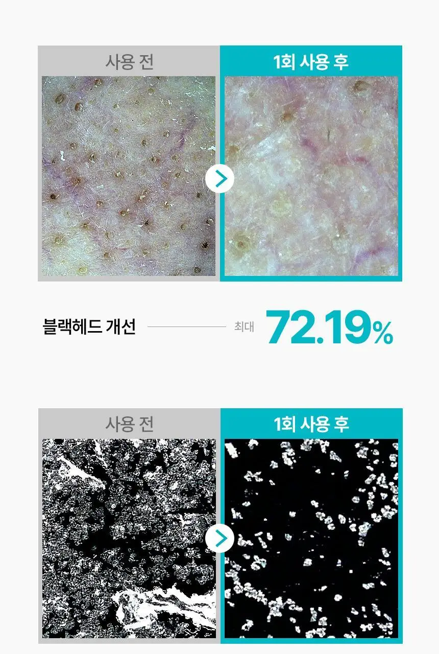 [800만개판매/1등피지클리너] 일소 슈퍼 멜팅 세범 소프트너 150g 기획 (+착붙솜 40매+모공텐션마스크팩1매) 상세페이지 10